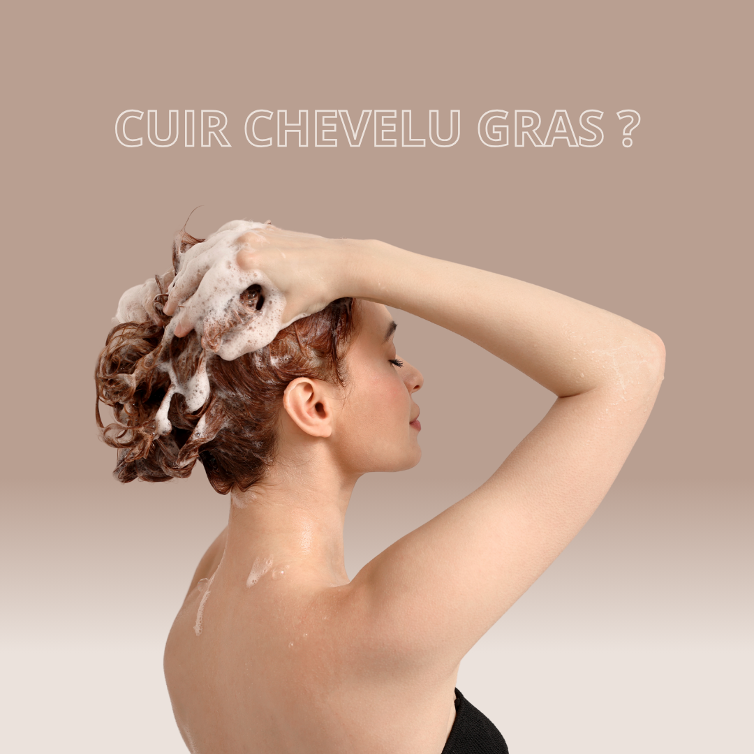 Un cuir chevelu gras ?