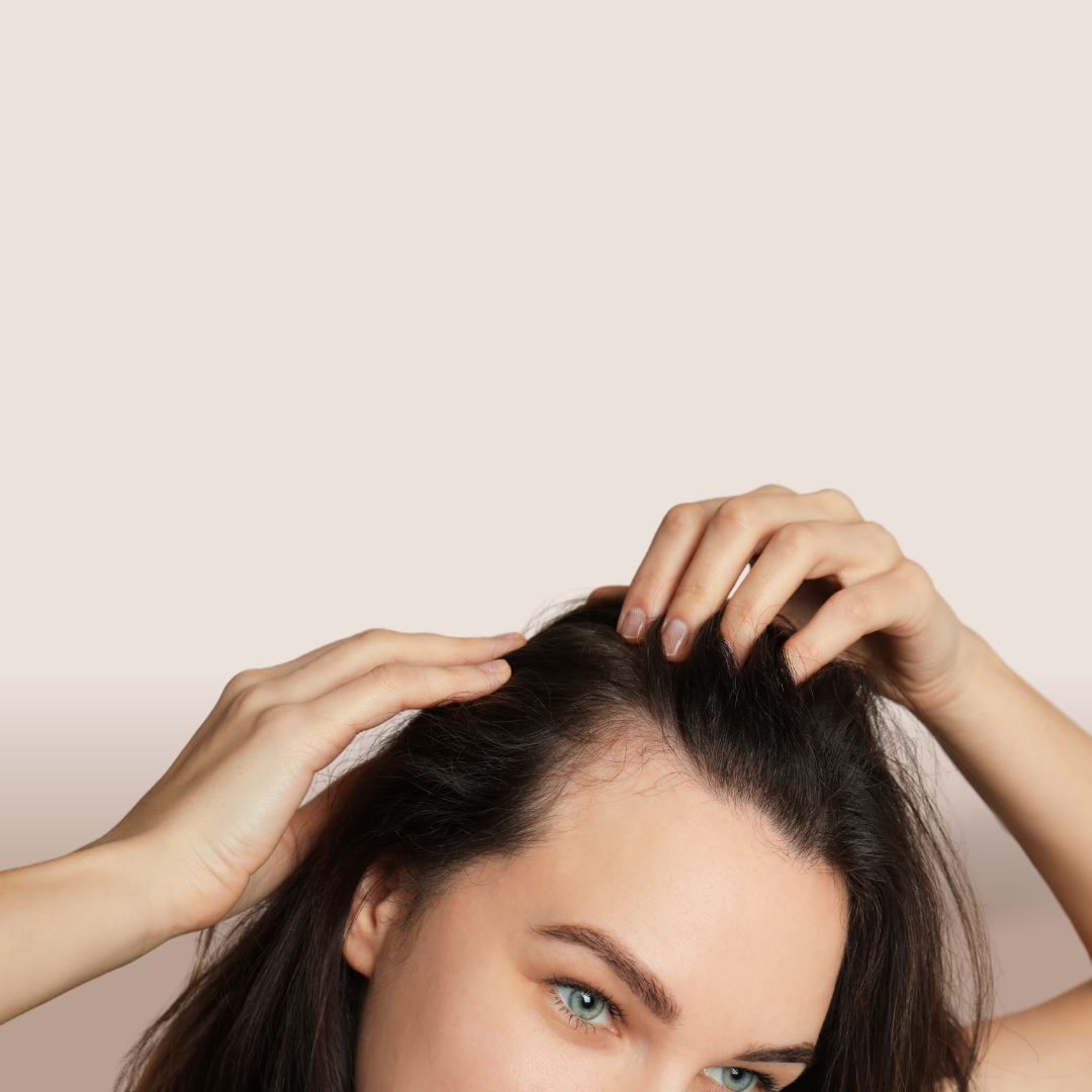 cheveux gras